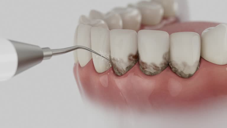 Trusted Tooth Extraction service in Teays Valley, WV - Dentist Open Now